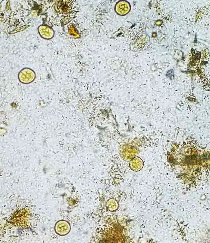 kystes d'entamoeba coli 